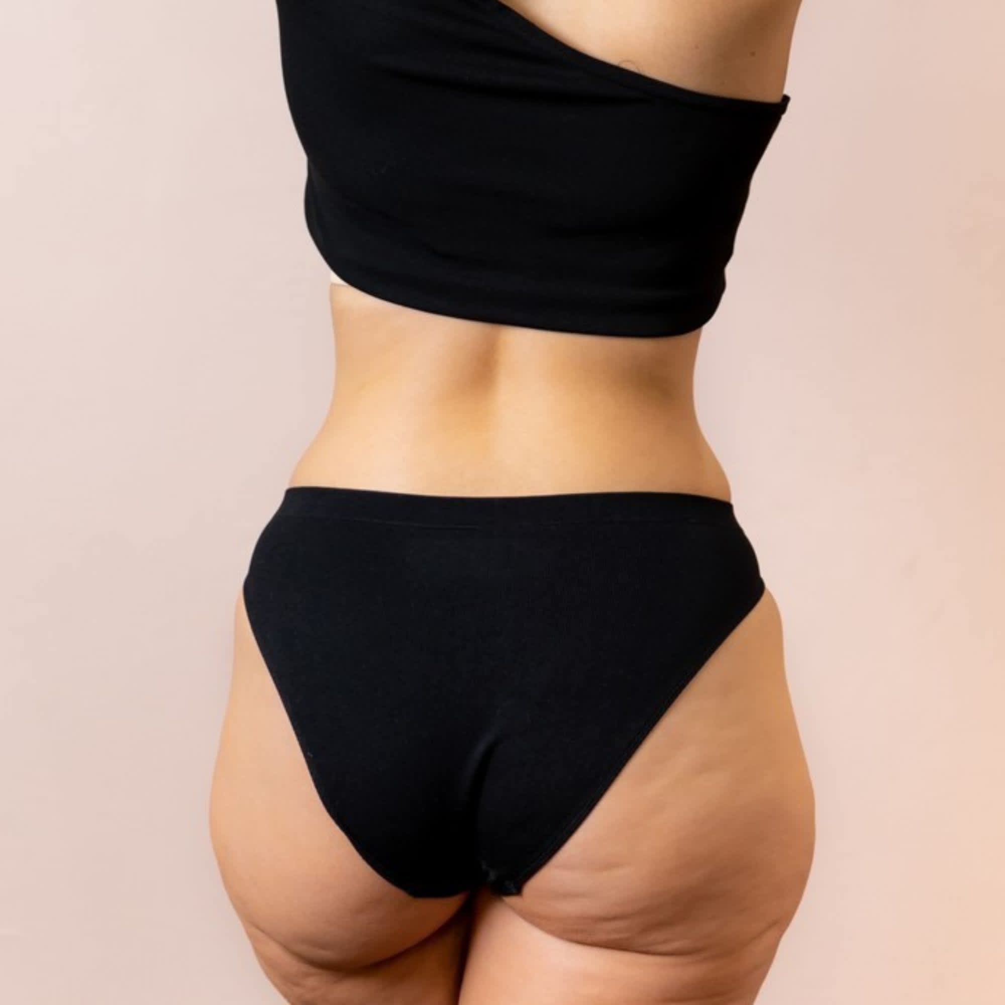 What is radio frequency bum lift and how long does it last