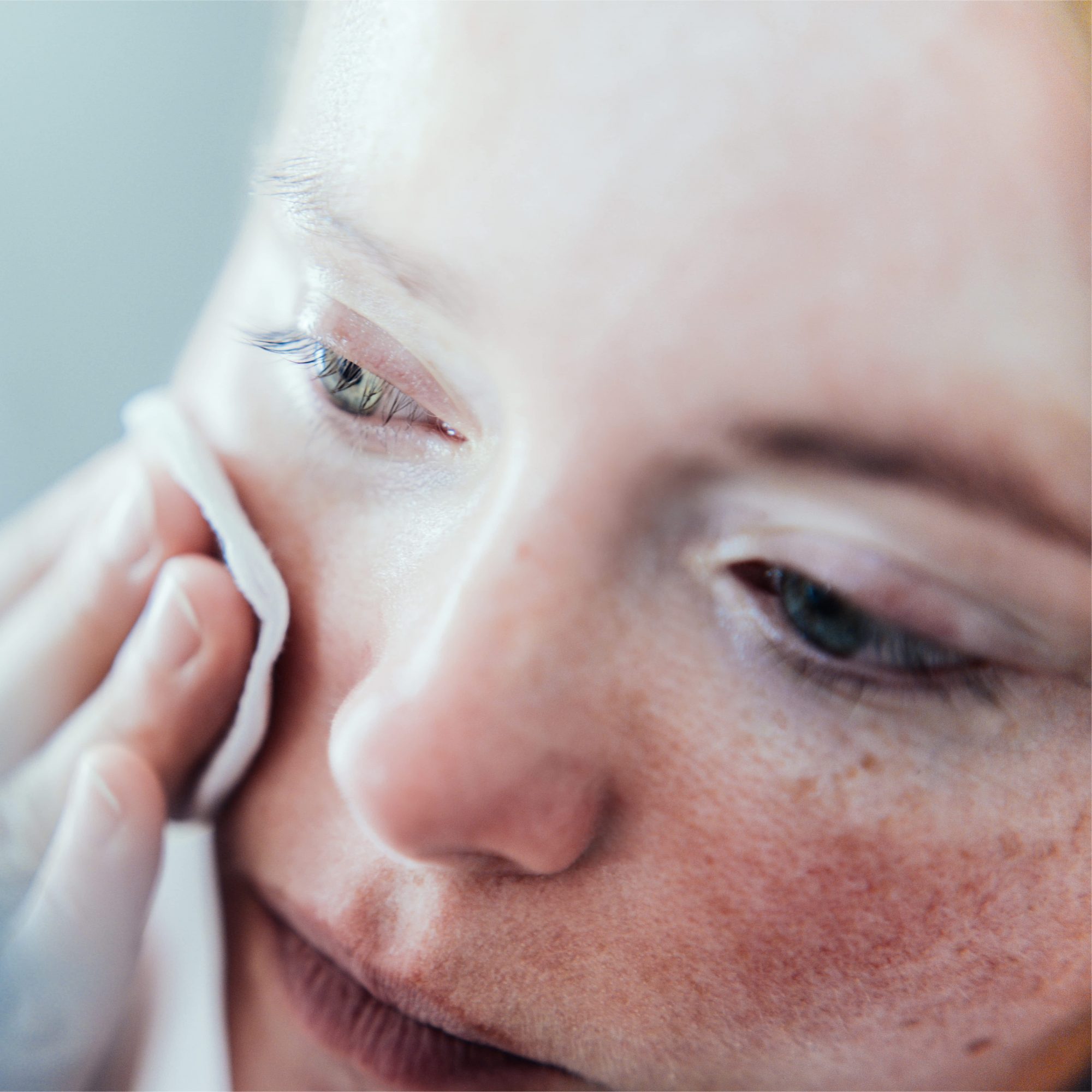 How To Know Once And For All Whether You Have Sensitive Skin